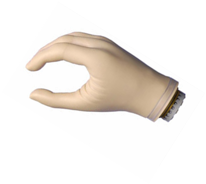 假肢廠家安裝手指假肢時(shí)會(huì)遇到哪種問題(圖1) 假肢廠家安裝手指假肢時(shí)會(huì)遇到哪種問題(圖1)