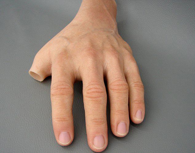 什么樣的殘肢適合安裝假肢河南假肢生產廠家(圖1) 什么樣的殘肢適合安裝假肢河南假肢生產廠家(圖1)